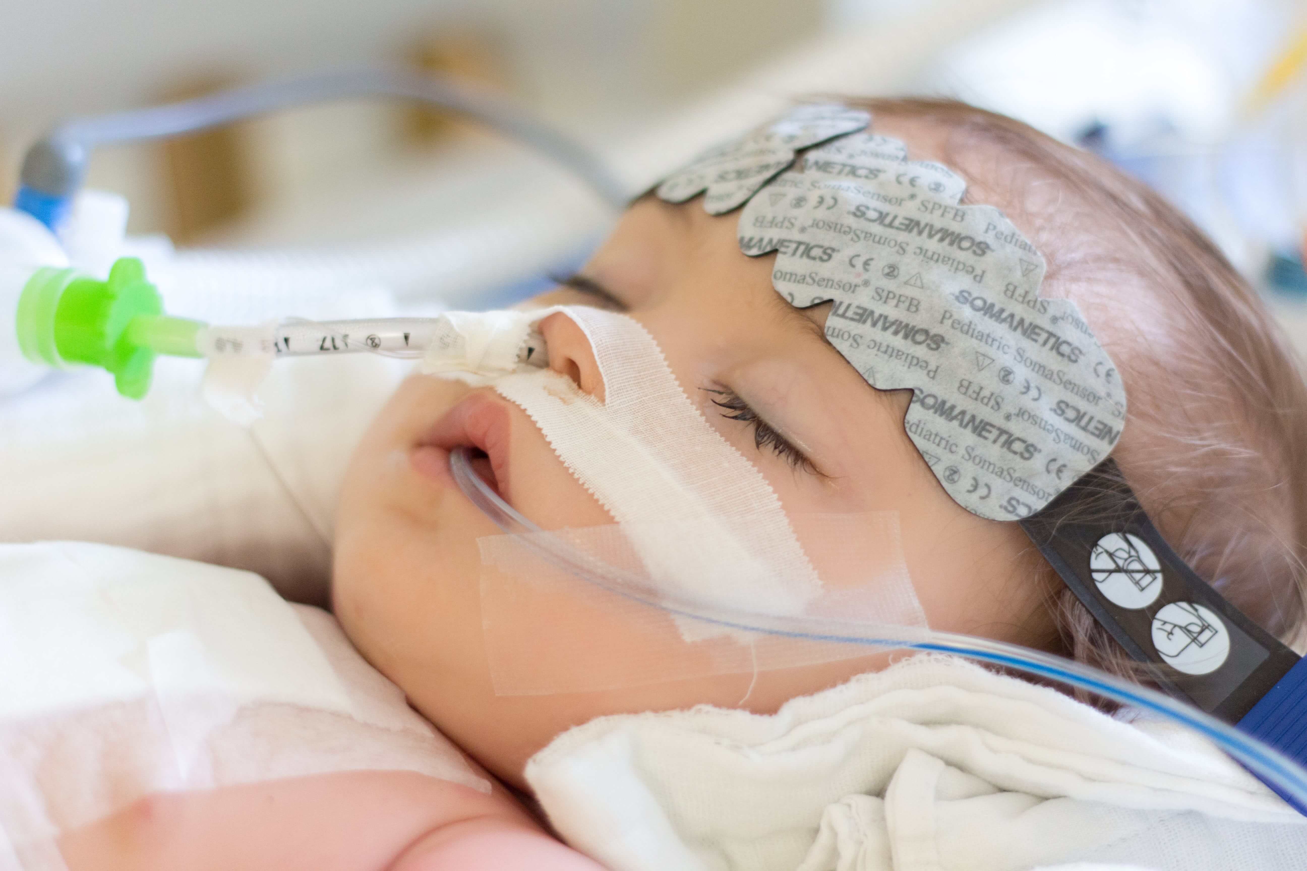 Fondation En Coeur - Bébé dormant sous aide respiratoire